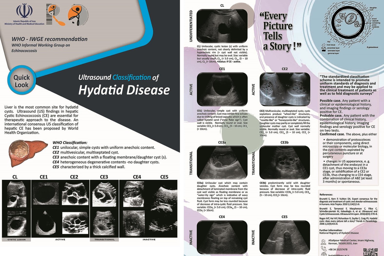 Professional education to improve diagnosis and treatment of CE – Posters with cyst classification guidance promote evidence-based diagnosis and treatment of CE